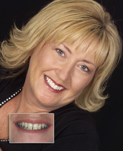 Cosmetic Dentistry in Cornwall
