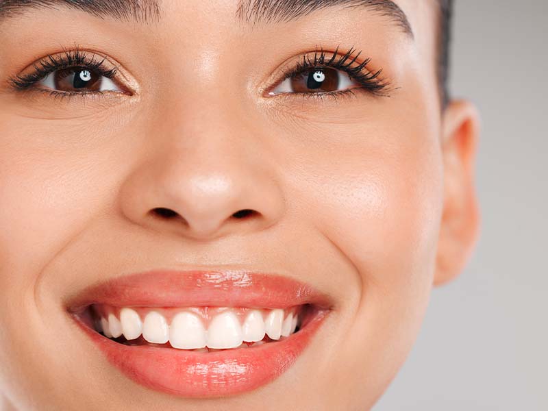 Professional teeth whitening and shade matching consultation