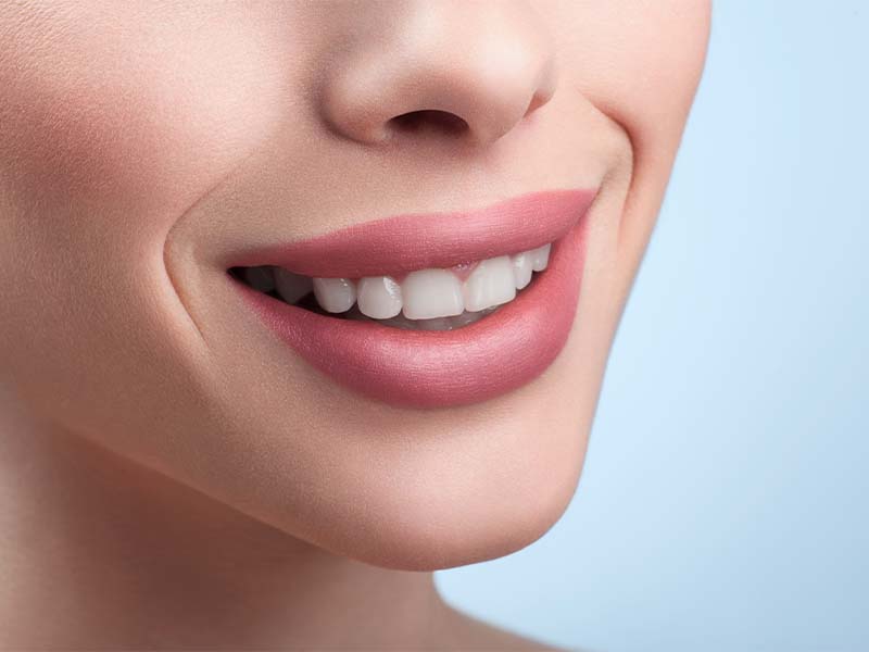 Veneers vs. Dental Bonding: Which Is Better for Your Smile?