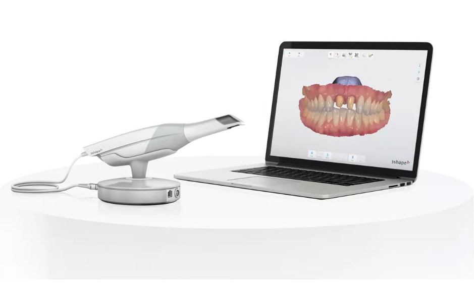 intra oral scanning at Cornwall dental arts in Cornwall, ON
